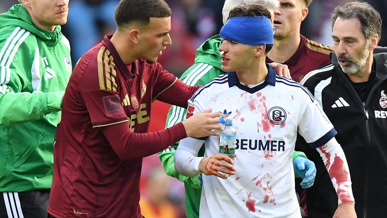 Kölns El Mala schubst – zwei Schalker blutig vom Platz! | Sport